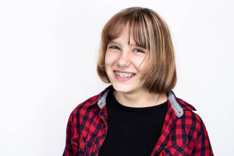 Dental braces on the teeth of a young teenage girl